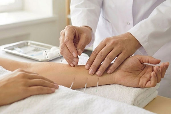 Acupuncture in Babylon NY treatment room for pain relief and stress support